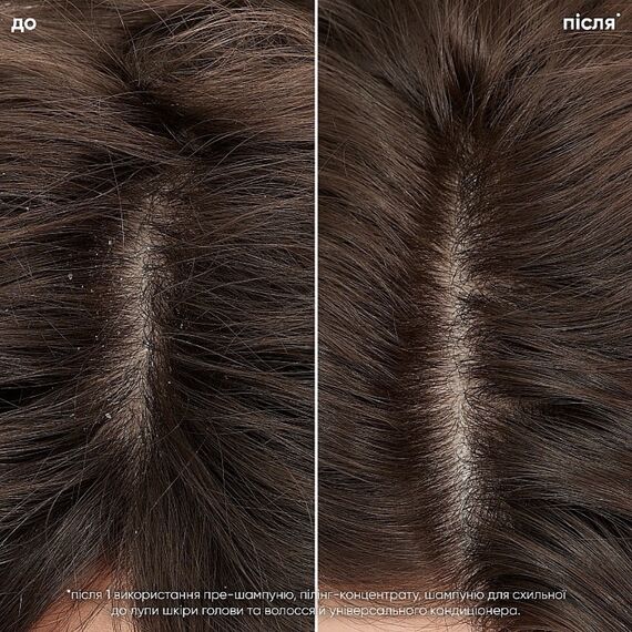 BIOLAGE Scalp Sync Universal Conditioner Універсальний кондиціонер для всіх типів шкіри голови та волосся, 200 мл, image _ab__is.image_number.default