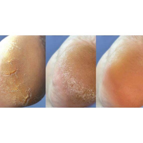 NAILSOFTHEDAY Podology+ Крем від тріщин для ніг та рук, 30 мл, image _ab__is.image_number.default