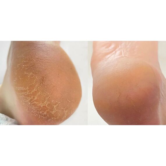 NAILSOFTHEDAY Podology+ Крем від тріщин для ніг та рук, 30 мл, image _ab__is.image_number.default