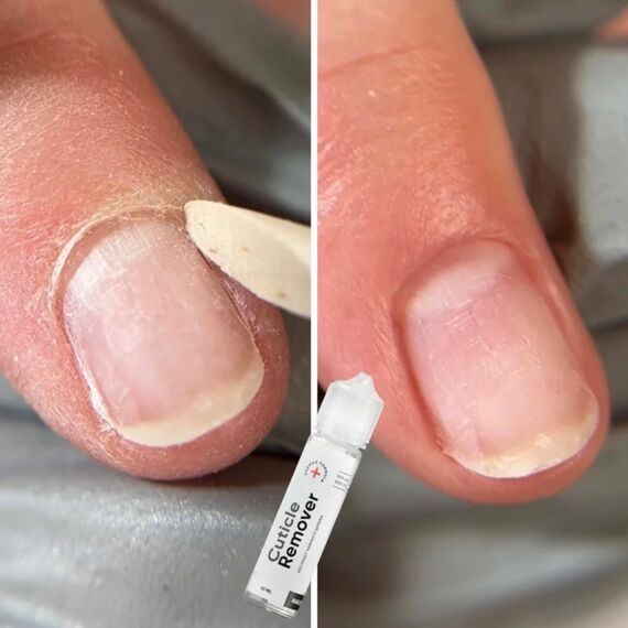 NAILSOFTHEDAY Cuticle Remover Ремувер для кутикули, 60 мл, image _ab__is.image_number.default