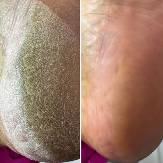 RESULTUM Anti Crack Cream Jojoba Крем від тріщин для рук та стоп з олією жожоба, 50 мл, Об'єм: 50 мл, Аромат: Jojoba, image _ab__is.image_number.default